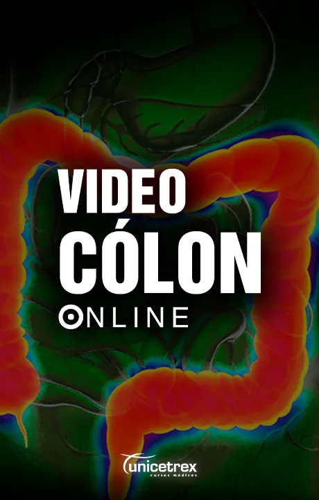 Cursos Essenciais para Avançar na Cirurgia Minimamente Invasiva - Imagem 8